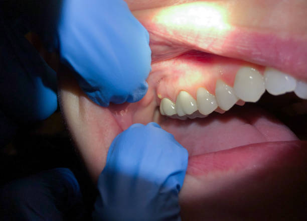 Best Same-Day Emergency Dentist in Winnie, TX